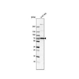28823. 5'-NUCLEOTIDASE/CD73 ANTIBODY 0.1ML NOVUS BIOLOGICALS