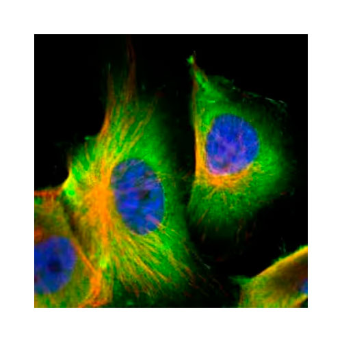 28193. S100A6 ANTIBODY 0.1ML NOVUS BIOLOGICALS