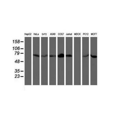 29546. LIM KINASE (OTI3H6) MOUSE MONOCLONAL 0.1ML NOVUS BIOLOGICALS