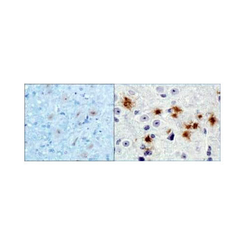 28166. BETA AMYLOID ANTIBODY (MOAB-2)-BSA FREE 0.1ML NOVUS BIOLOGICALS