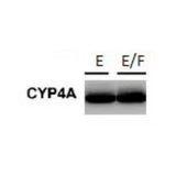 28827. CYTOCHROME P450 4F11 ANTIBODY 0.1ML NOVUS BIOLOGICALS