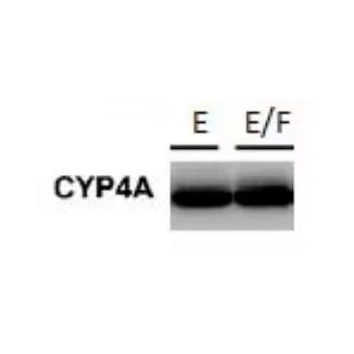 28827. CYTOCHROME P450 4F11 ANTIBODY 0.1ML NOVUS BIOLOGICALS