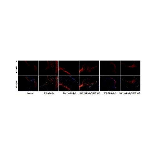 29982. ALPHA-SMOOTH MUSCLE ACTIN ANTIBODY (4A4) 0.025ML NOVUS BIOLOGICALS
