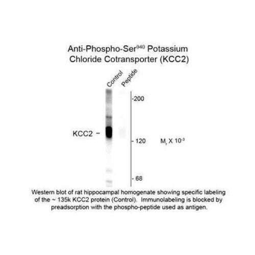 28185. KCC2/SLC12A5 (P SER940) ANTIBODY 0.1ML NOVUS BIOLOGICALS