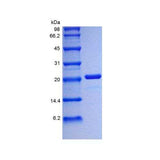 29534. RECOMBINANT HUMAN IL-6 PROTEIN 5UG NOVUS BIOLOGICALS