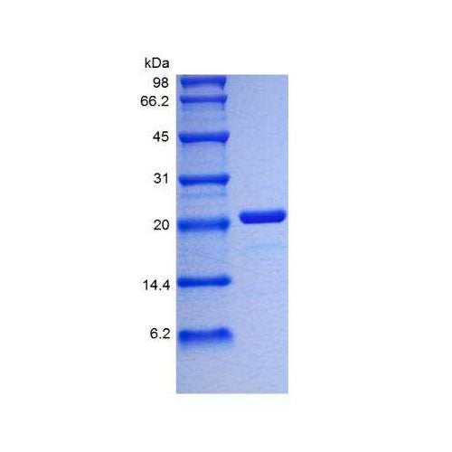 29534. RECOMBINANT HUMAN IL-6 PROTEIN 5UG NOVUS BIOLOGICALS