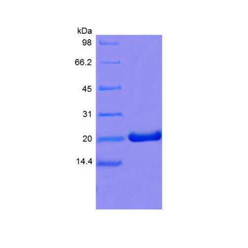 28192. RECOMBINANT MOUSE PROLACTIN PROTEIN 1MG NOVUS BIOLOGICALS