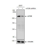 29993. TOR/MTOR ANTIBODY (6611) 0.1ML NOVUS BIOLOGICALS