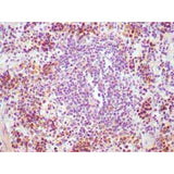28172. CD8 ANTIBODY (V44P1H9 F11) (BIOTIN) 0.1ML NOVUS BIOLOGICALS
