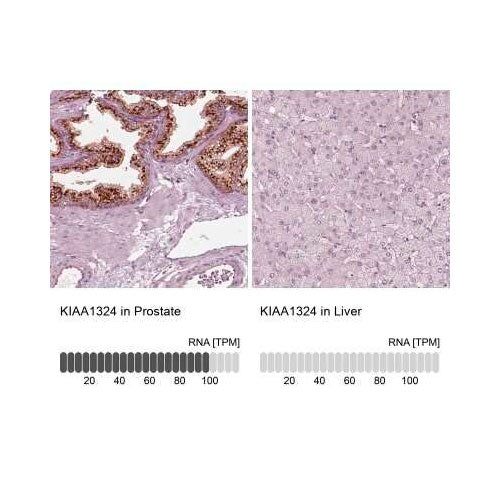 29548. ANTIBODY POLYCLONAL RABBIT EIG121 100UL NOVUS BIOLOGICALS