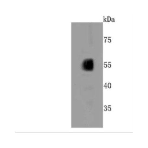 28174. CYTOCHROME P450 2E1 ANTIBODY (JM10-85) 100UL NOVUS BIOLOGICALS
