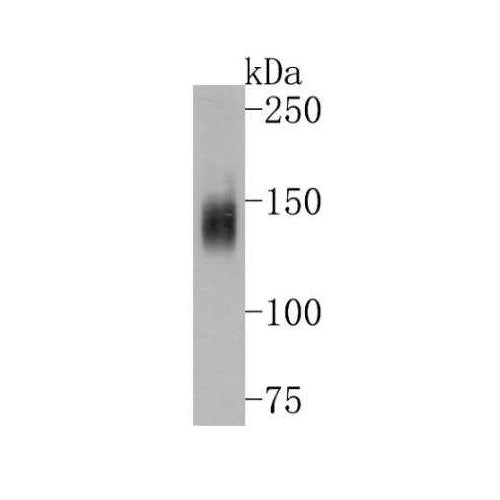 29990. MDR1/ABCB1 ANTIBODY (SN06-42) 100UL NOVUS BIOLOGICALS