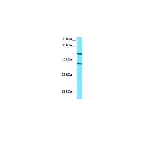 28834. RABBIT POLYCLONAL CYP4F2 100UL NOVUS BIOLOGICALS