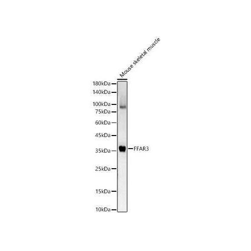 29274. FFAR3/GPR41 ANTIBODY 100UL NOVUS BIOLOGICALS