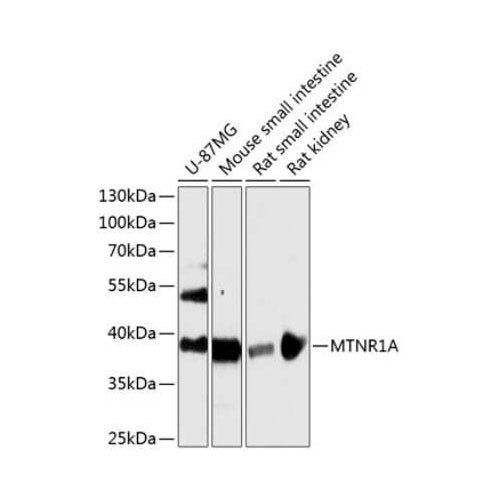 29555. MELATONIN R1A/MT1/MTNR1A ANTIBODY 100UL NOVUS BIOLOGICALS