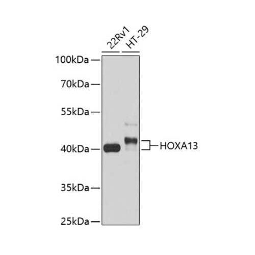 28179. HOXA13 ANTIBODY RABBIT POLYCLONAL 20UL NOVUS BIOLOGICALS