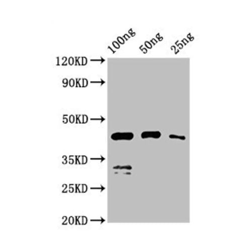 28660. CHICKEN ANEMIA VIRUS VP1 POLYCLNAL ANTIBODY 100UL INVITROGEN