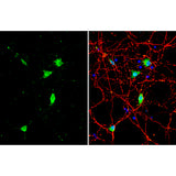 31054. BDNF POLYCLONAL ANTIBODY 100UL INVITROGEN