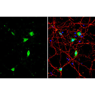31054. BDNF POLYCLONAL ANTIBODY 100UL INVITROGEN