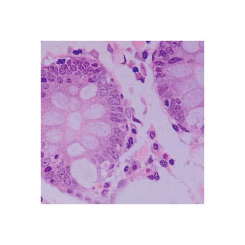 21715. KIT DE INCLUSION JB-4 - POLYSCIENCES