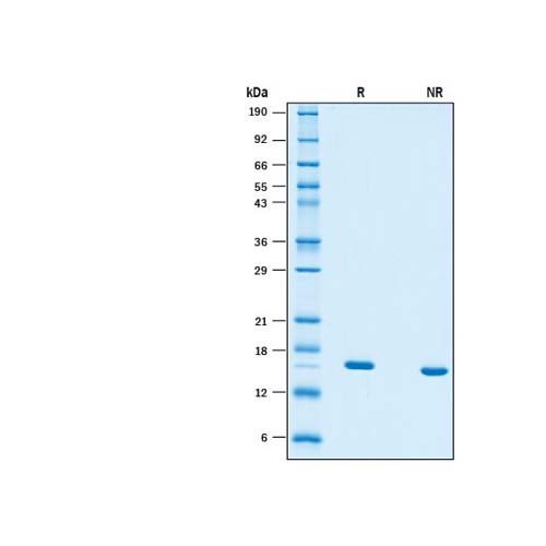 15848. RECOMBINANT HUMAN TNF-ALPHA (HEK293-EXPRESSED) PROTEIN CF 20UG - R&D SYSTEMS