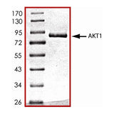 25718. RECOMBINANT HUMAN ACTIVE AKT1 PROTEIN CF 10UG R&D SYSTEMS