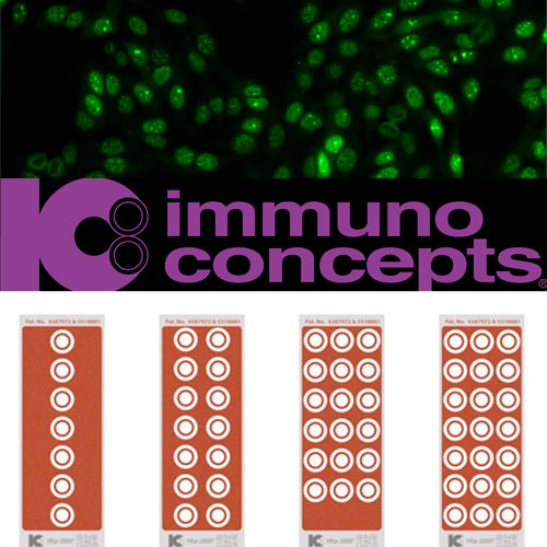 25543. SISTEMA DE ANALISIS DE ANA-RO POR INMUNOFLUORESCENCIA HEP-2000 IMMUNO CONCEPTS 70 PRUEBAS - IMMUNO CONCEPTS