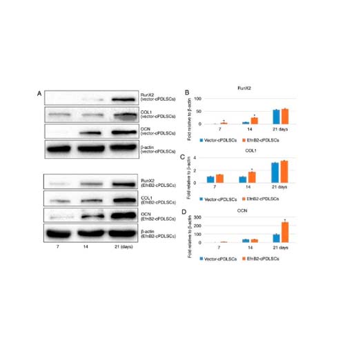 21872. OSTEOCALCIN MONOCLONAL ANTIBODY (OC4-30) 100UG - INVITROGEN