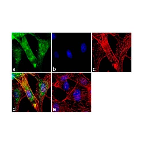 21873. DOUBLECORTIN POLYCLONAL ANTIBODY 100UG - INVITROGEN