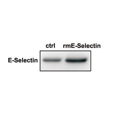 7513. RECOMBINANT MOUSE E-SELECTIN/CD62E FC CHIMERA PROTEIN CF 100UG  - R&D SYSTEMS