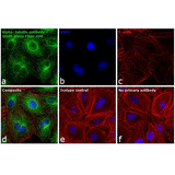 22463. GOAT ANTI RAT IGG (H+L) CROSS-ADSORBED SECONDARY ANTIBODY ALEXA FLUOR 488  1MG INVITROGEN