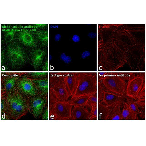 22463. GOAT ANTI RAT IGG (H+L) CROSS-ADSORBED SECONDARY ANTIBODY ALEXA FLUOR 488  1MG INVITROGEN