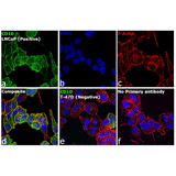 22459. GOAT ANTI-MOUSE IGG2B CROSS-ADSORBED SECONDARY ANTIBODY ALEXA FLUOR 488  500UG INVITROGEN