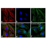 22466. GOAT ANTI-MOUSE IGG (H+L) HIGHLY CROSS-ADSORBED SECONDARY ANTIBODY ALEXA FLUOR 555 1MG INVITROGEN