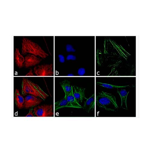 21882. GOAT ANTI-RABBIT IGG (H+L) CROSS-ADSORBED SECONDARY ANTIBODY, ALEXA FLUOR 555 1MG - INVITROGEN