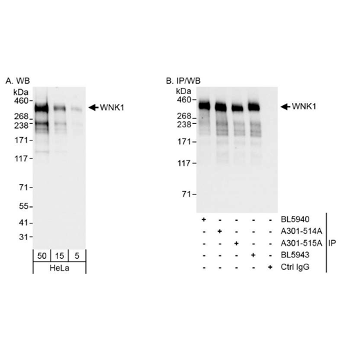 20988. RABBIT ANTI-WNK1 ANTIBODY 20UG - BETHYL LABS