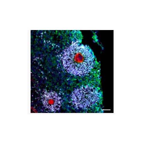 21880. DONKEY ANTI-RABBIT IGG (H+L) HIGHLY CROSS-ADSORBED SECONDARY ANTIBODY ALEXA FLUOR 647, 1MG - INVITROGEN