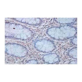 22754. ANTI-IL-12 P40 ANTIBODY 100UG ABCAM