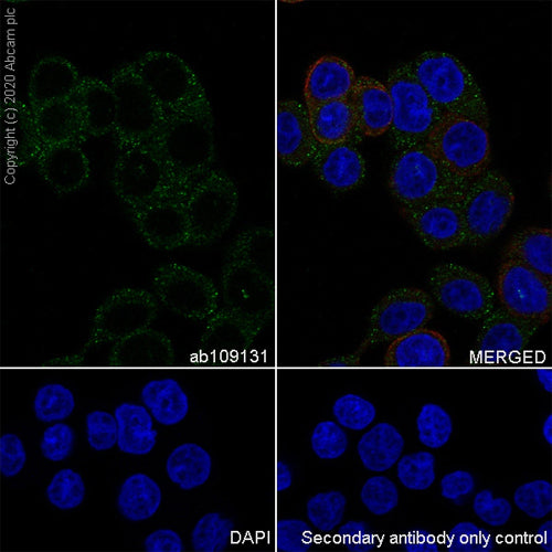 4641. RECOMBINANT ANTI-TMPRSS2 ANTIBODY (EPR3862) 100UL - ABCAM