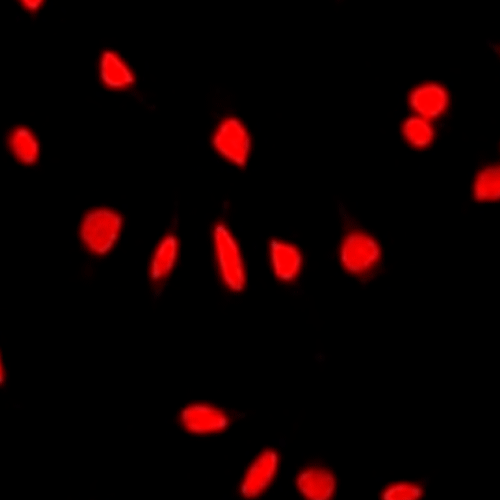 26435. RECOMBINANT ANTI-NUMA ANTIBODY (EP3976) 100UL ABCAM