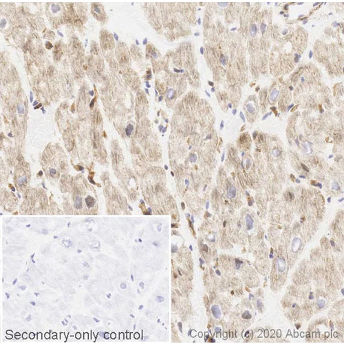 4667. RECOMBINANT ANTI-MTOR (PHOSPHO S2448) ANTIBODY (EPR426(2)) 100UL - ABCAM