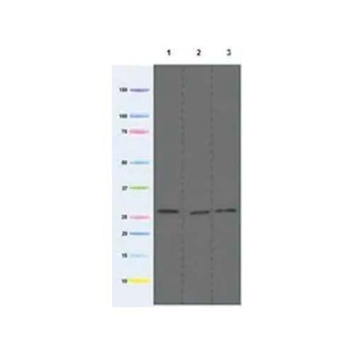 22755. ANTI-MTCO3 ANTIBODY (DA5BC4) 100UG ABCAM