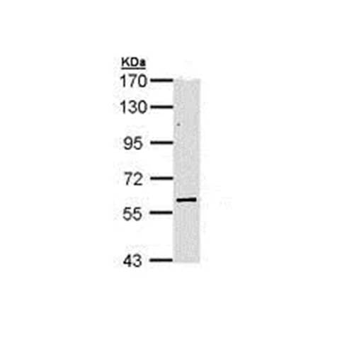 22758. ANTI-KAT9/ELP3 ANTIBODY 50UL ABCAM