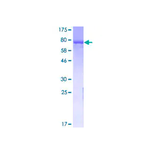 56868. RECOMBINANT HUMAN GAD65 PROTEIN 10UG ABCAM