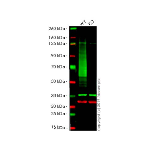 22762. RECOMBINANT ANTI-GLUCOSE TRANSPORTER GLUT1 ANTIBODY (EPR3915) 100UL ABCAM