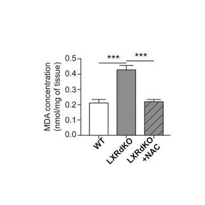 56873. LIPID PEROXIDATION (MDA) ASSAY KIT (COLORIMETRIC/FLUOROMETRIC 100 TESTS - ABCAM