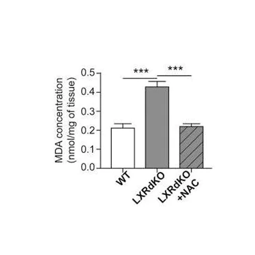 56873. LIPID PEROXIDATION (MDA) ASSAY KIT (COLORIMETRIC/FLUOROMETRIC 100 TESTS - ABCAM