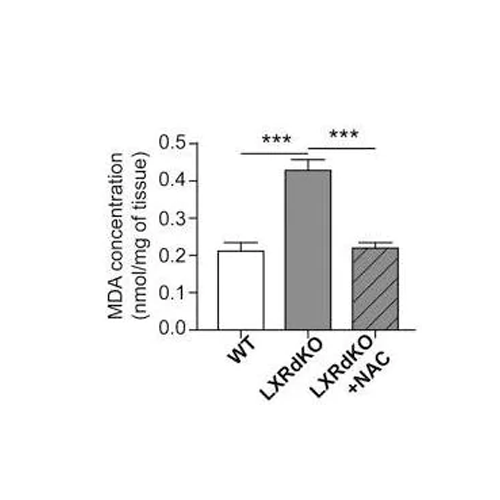 17768. LIPID PEROXIDATION (MDA) ASSAY KIT (COLORIMETRIC/FLUOROMETRIC 100 TESTS - ABCAM