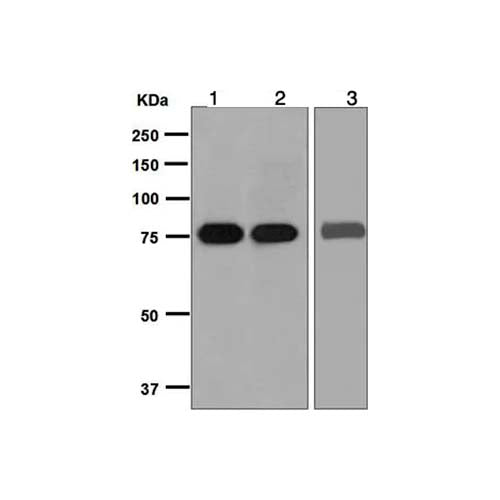 22766. RECOMBINANT ANTI-SLC22A3/OCT3 ANTIBODY (EPR6630) 100UL ABCAM