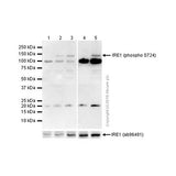22768. RECOMBINANT ANTI-IRE1 (PHOSPHO S724) ANTIBODY (EPR5253) 100UL ABCAM